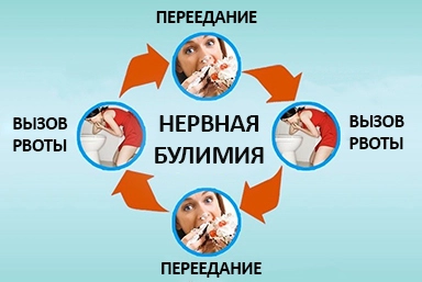 Лечение булимии в Левокумском